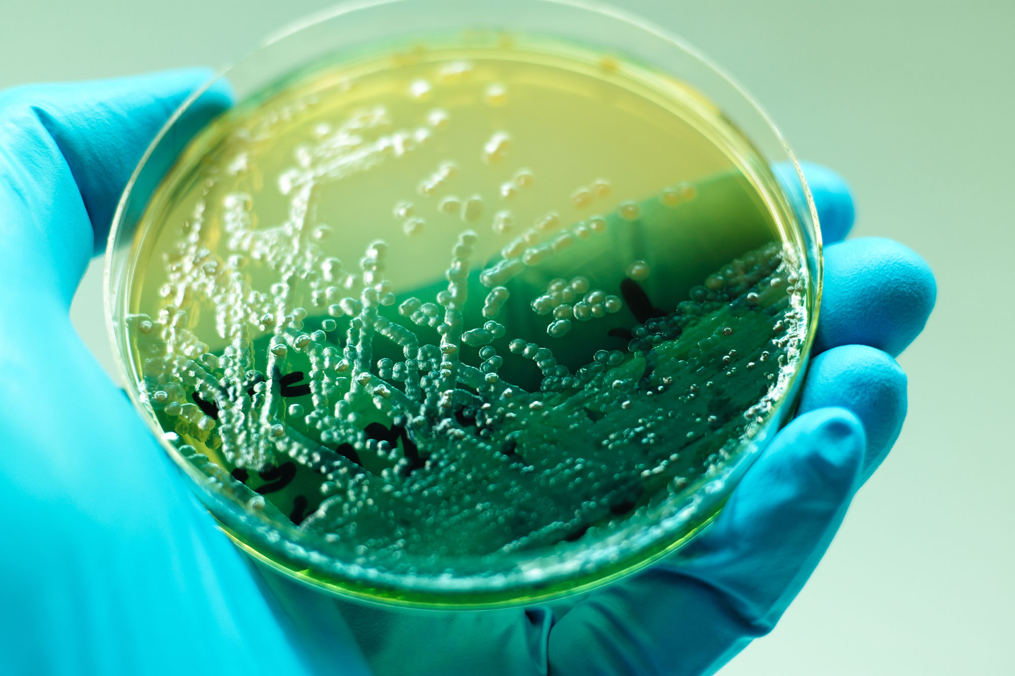 Petrie Dish in a Lab