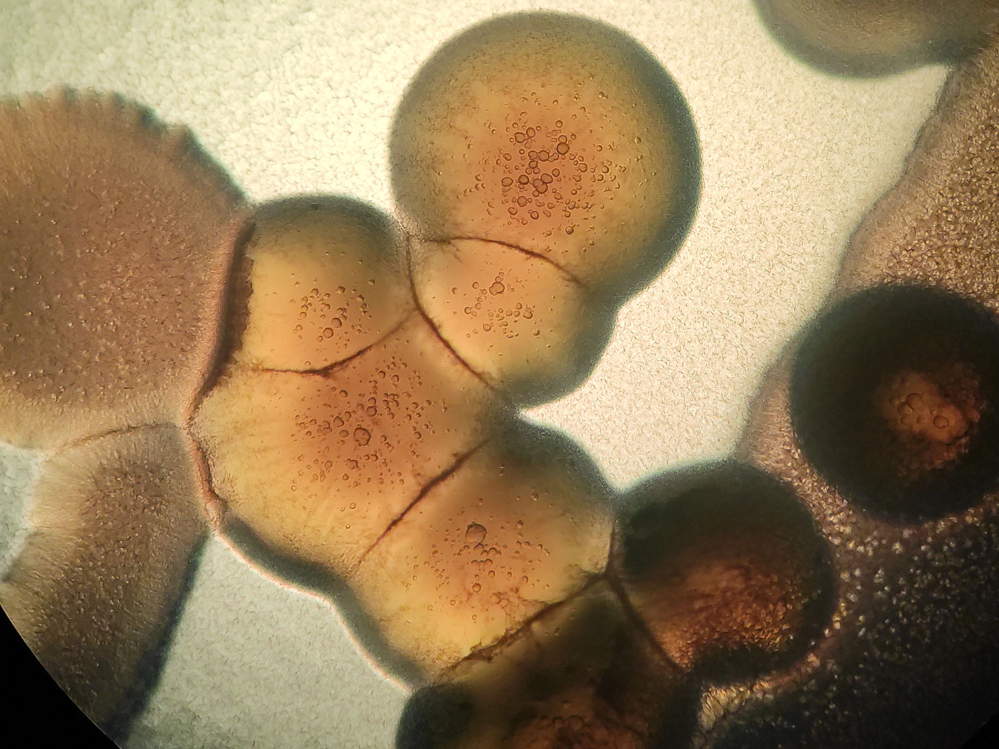 Pseudomonas